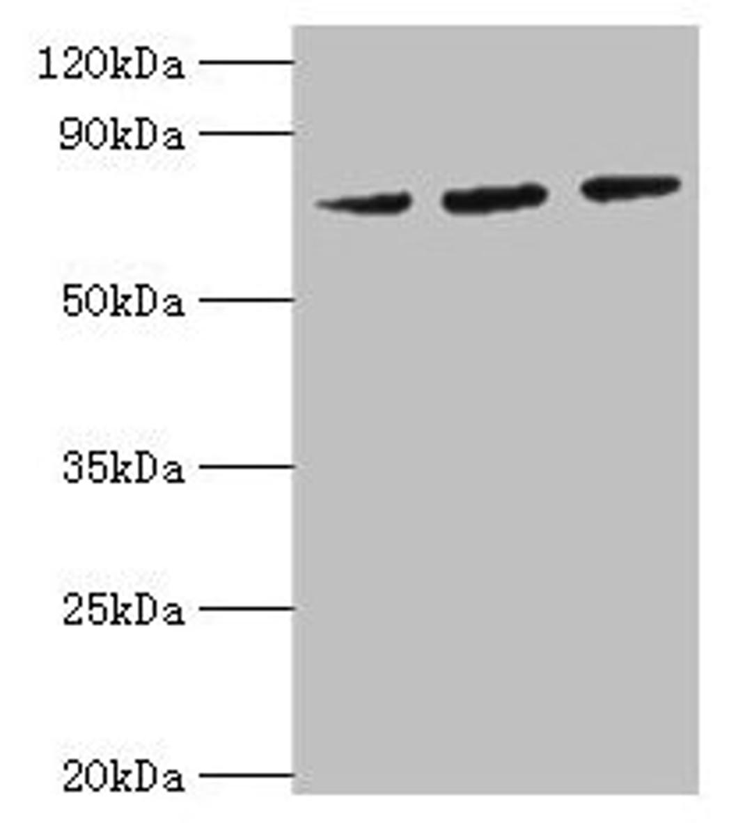 Western blot. All lanes: HSPA6 antibody at 2µg/ml. Lane 1: MCF-7 whole cell lysate. Lane 2: A431 whole cell lysate. Lane 3: Jurkat whole cell lysate. Secondary. Goat polyclonal to rabbit IgG at 1/10000 dilution. Predicted band size: 72 kDa. Observed band size: 72 kDa