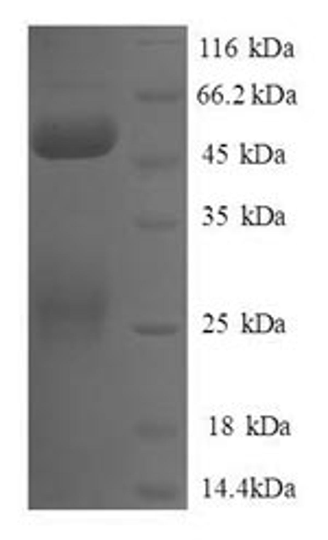 (Tris-Glycine gel) Discontinuous SDS-PAGE (reduced) with 5% enrichment gel and 15% separation gel.