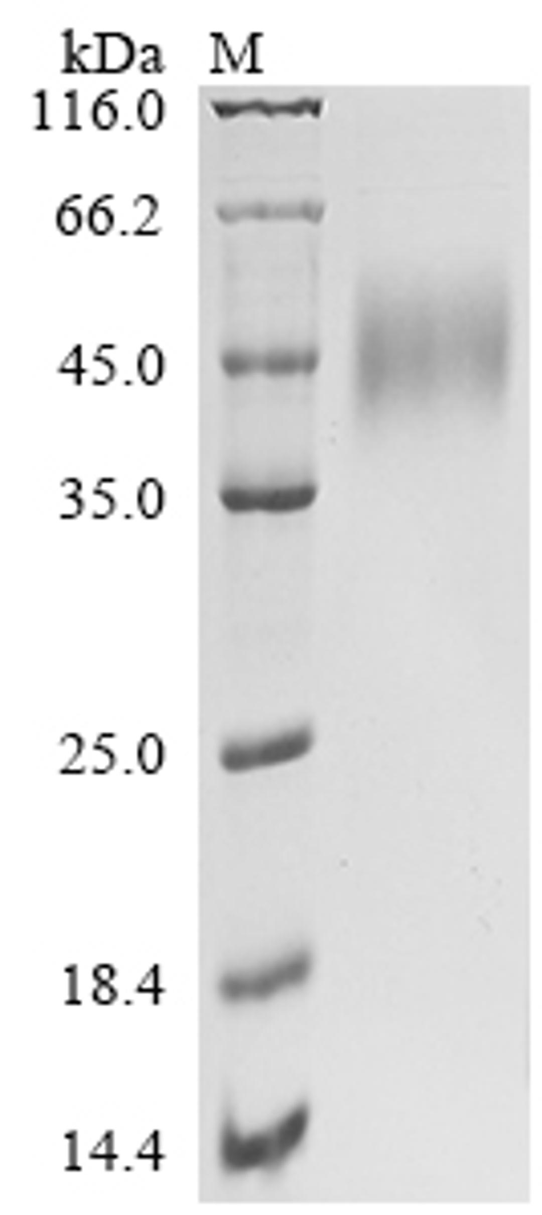 (Tris-Glycine gel) Discontinuous SDS-PAGE (reduced) with 5% enrichment gel and 15% separation gel.