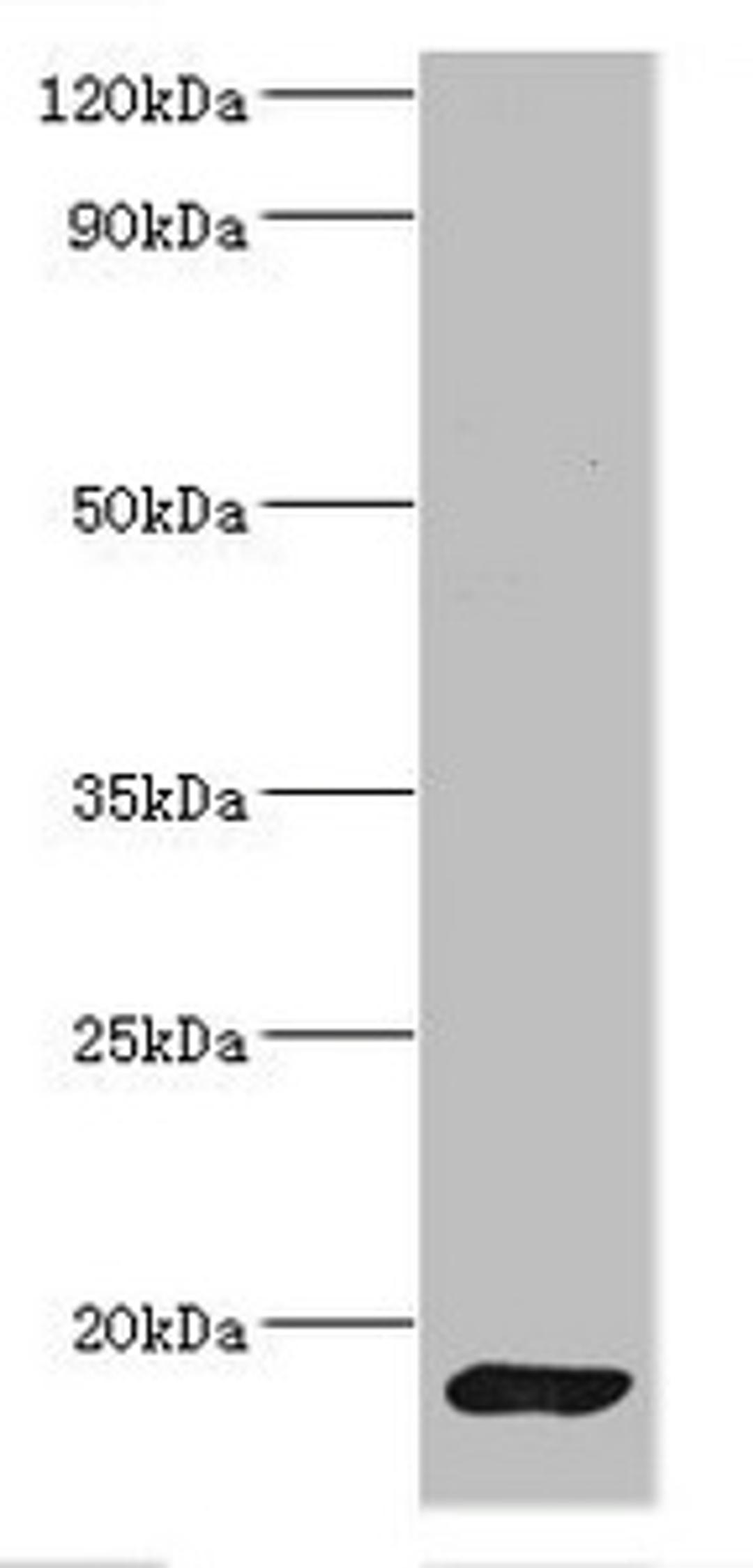 Western blot. All lanes: CALM1 antibody at 2µg/ml + Mouse skeletal muscle tissue. Secondary. Goat polyclonal to rabbit IgG at 1/10000 dilution. Predicted band size: 17 kDa. Observed band size: 17 kDa