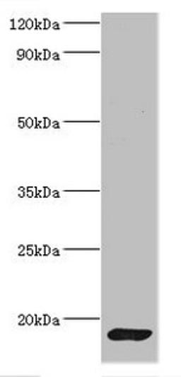 Western blot. All lanes: CALM1 antibody at 2µg/ml + Mouse skeletal muscle tissue. Secondary. Goat polyclonal to rabbit IgG at 1/10000 dilution. Predicted band size: 17 kDa. Observed band size: 17 kDa