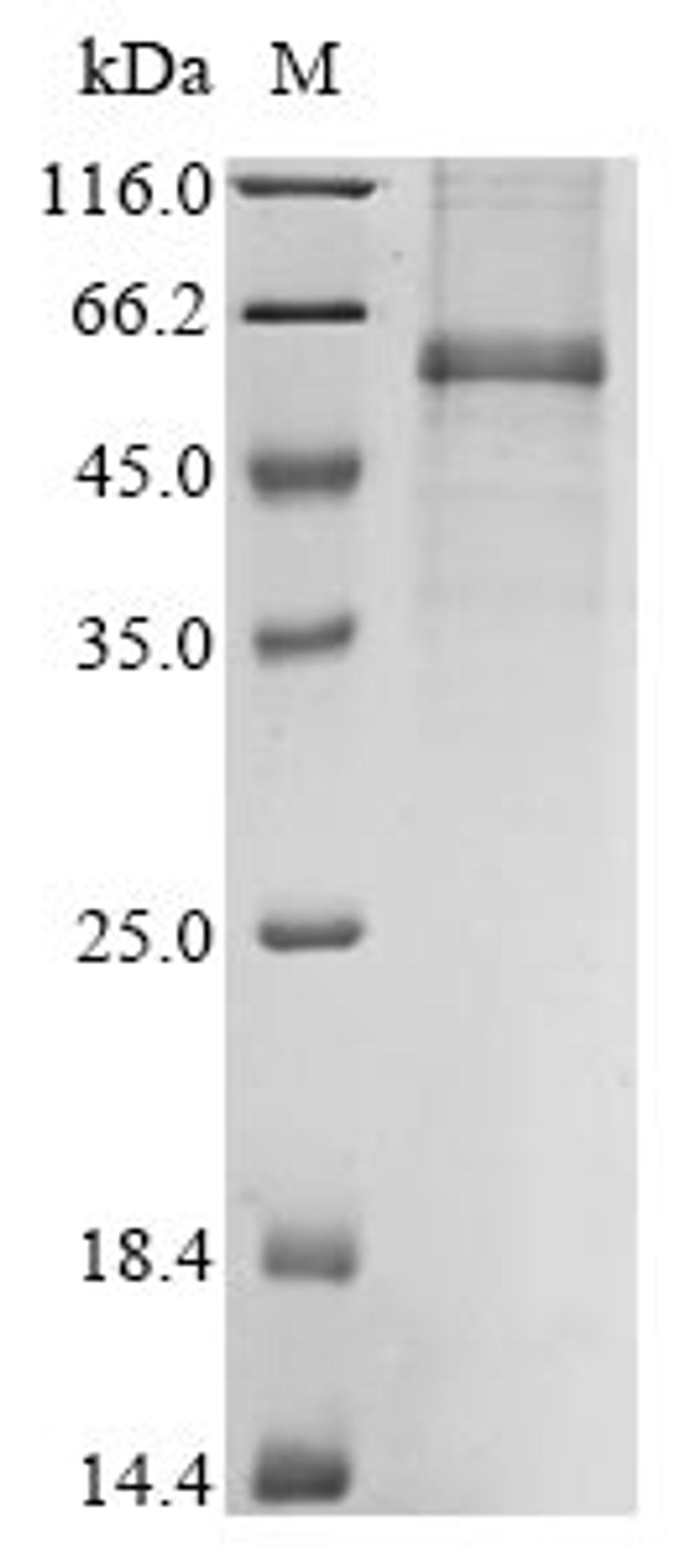 (Tris-Glycine gel) Discontinuous SDS-PAGE (reduced) with 5% enrichment gel and 15% separation gel.