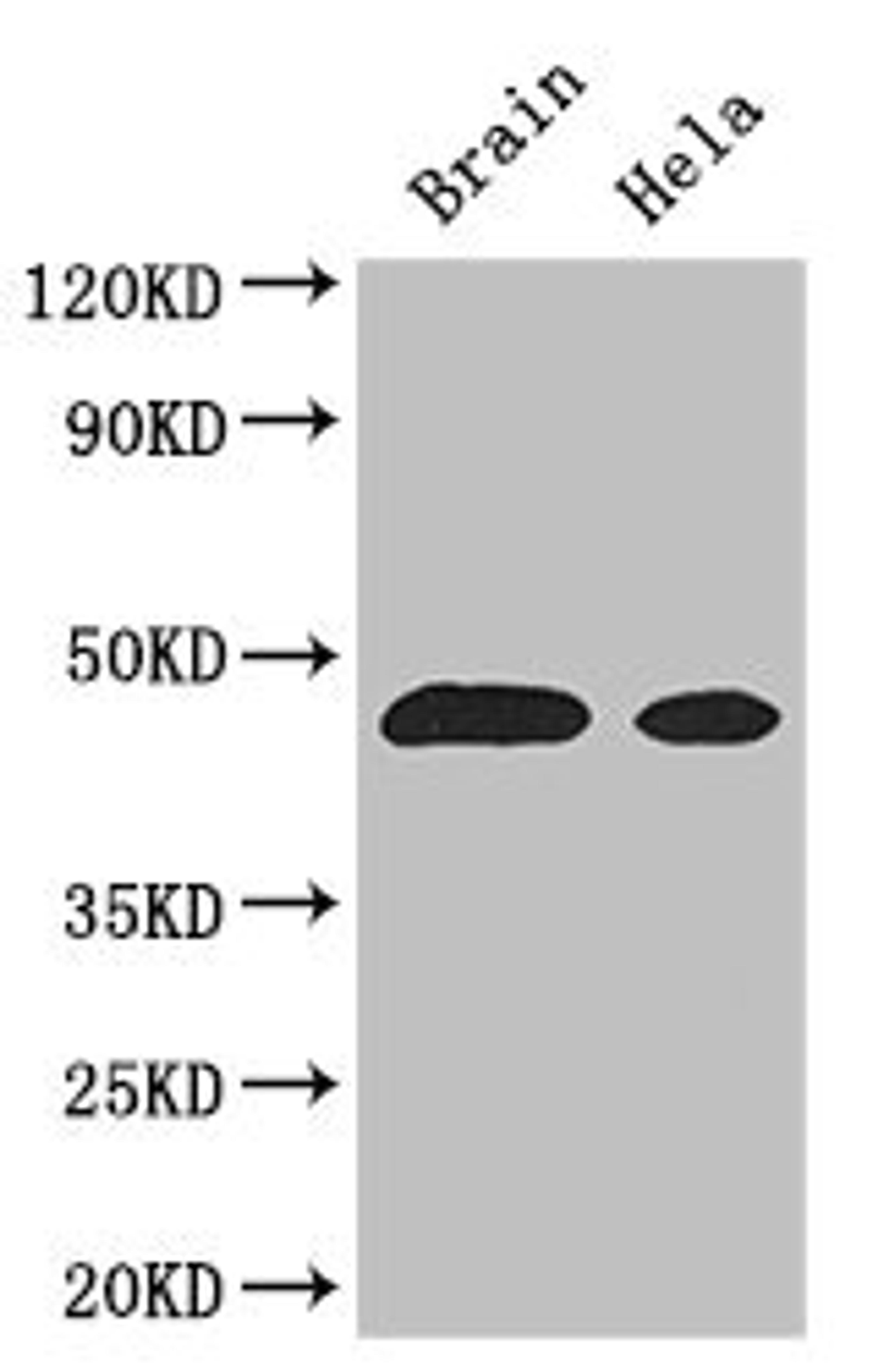 Western Blot. Positive WB detected in: Mouse brain tissue, Hela whole cell lysate. All lanes: ASS1 antibody at 3µg/ml. Secondary. Goat polyclonal to rabbit IgG at 1/50000 dilution. Predicted band size: 47 kDa. Observed band size: 47 kDa