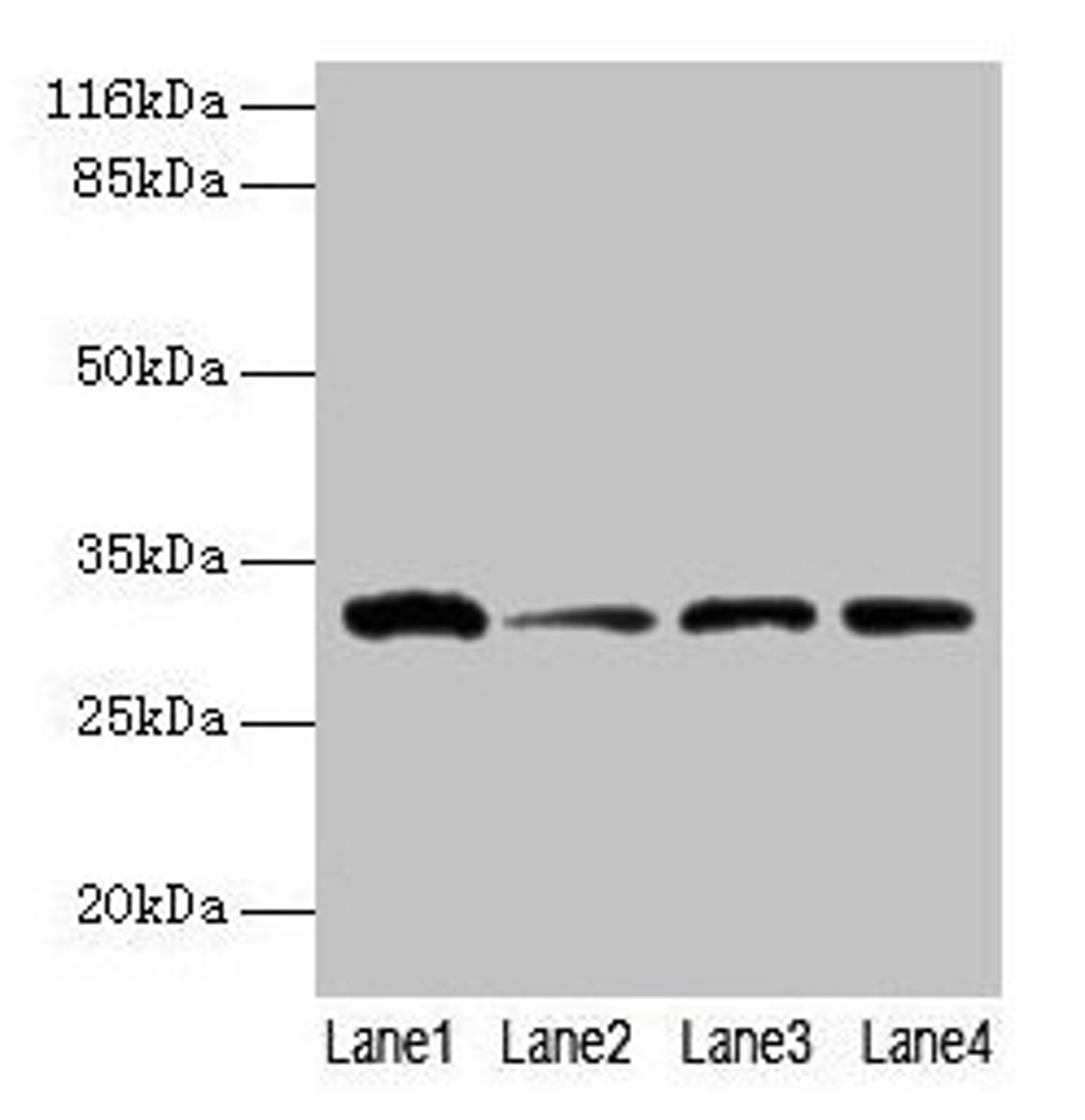 Western blot. All lanes: GSTK1 antibody at 2µg/ml. Lane 1: 293T whole cell lysate. Lane 2: Hela whole cell lysate. Lane 3: A431 whole cell lysate. Lane 4: COLO205 whole cell lysate. Secondary. Goat polyclonal to rabbit IgG at 1/10000 dilution. Predicted band size: 26, 32, 25, 21 kDa. Observed band size: 32 kDa