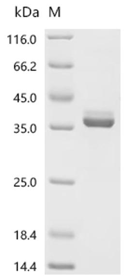 (Tris-Glycine gel) Discontinuous SDS-PAGE (reduced) with 5% enrichment gel and 15% separation gel.