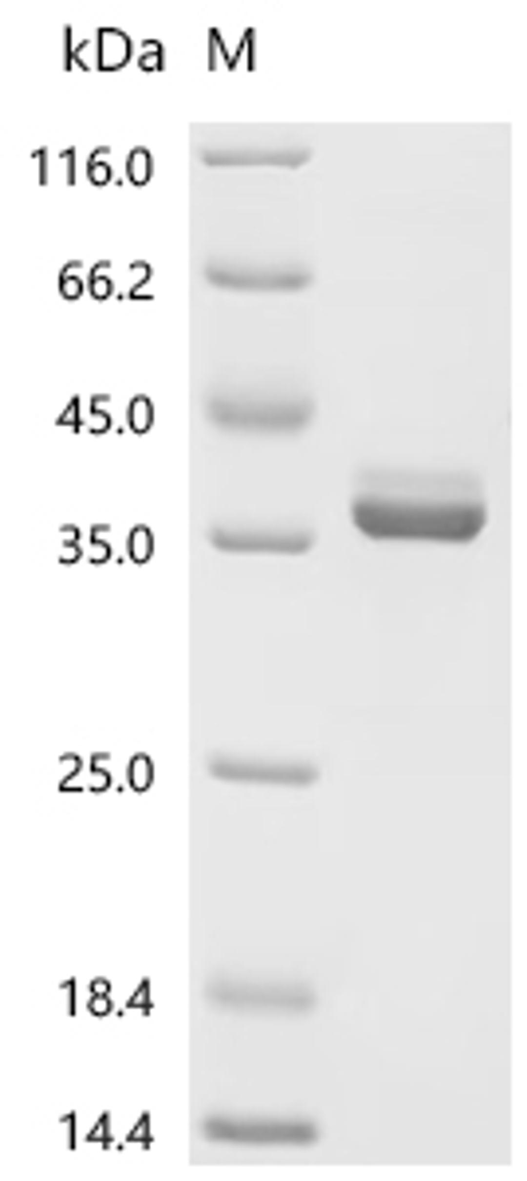 (Tris-Glycine gel) Discontinuous SDS-PAGE (reduced) with 5% enrichment gel and 15% separation gel.