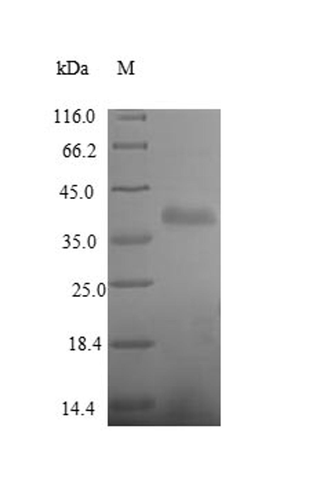 (Tris-Glycine gel) Discontinuous SDS-PAGE (reduced) with 5% enrichment gel and 15% separation gel.