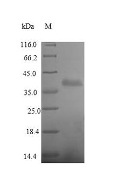 (Tris-Glycine gel) Discontinuous SDS-PAGE (reduced) with 5% enrichment gel and 15% separation gel.