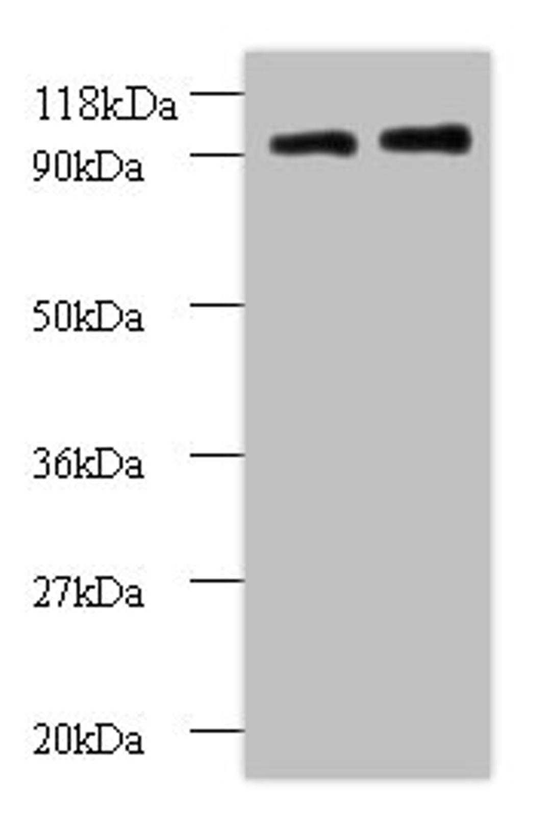 Western blot. All lanes: RPS12 antibody at 2µg/ml. Lane 1: EC109 whole cell lysate. Lane 2: 293T whole cell lysate. Secondary. Goat polyclonal to rabbit IgG at 1/15000 dilution. Predicted band size: 15 kDa. Observed band size: 90 kDa