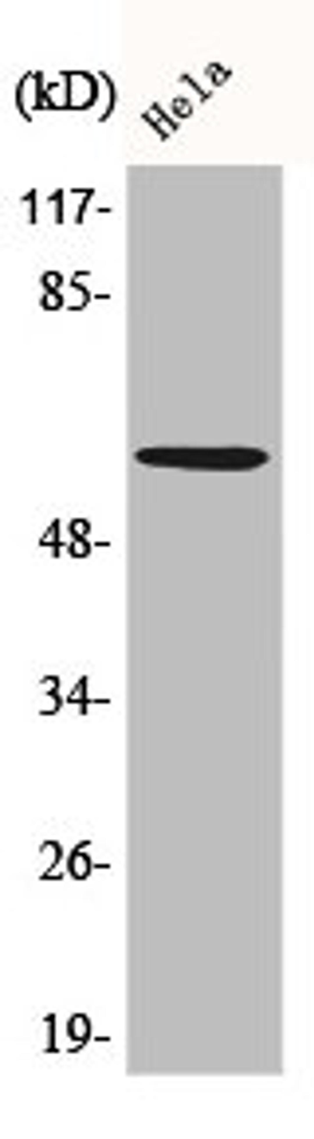 Western Blot analysis of HeLa cells using Akt Polyclonal Antibody