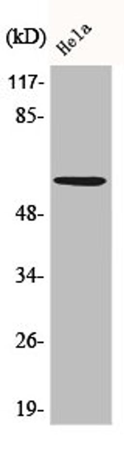 Western Blot analysis of HeLa cells using Akt Polyclonal Antibody