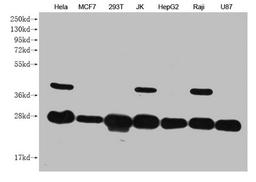 Western Blot. Positive WB detected in: Hela whole cell lysate, MCF7 whole cell lysate, 293T whole cell lysate, JK whole cell lysate, HepG2 whole cell lysate, Raji whole cell lysate, U87 whole cell lysate . All lanes: PRDX3 antibody at 1:1000. Secondary. Goat polyclonal to mouse IgG at 1/50000 dilution. Predicted band size: 28 kDa. Observed band size: 28 KDa. Exposure time:5min