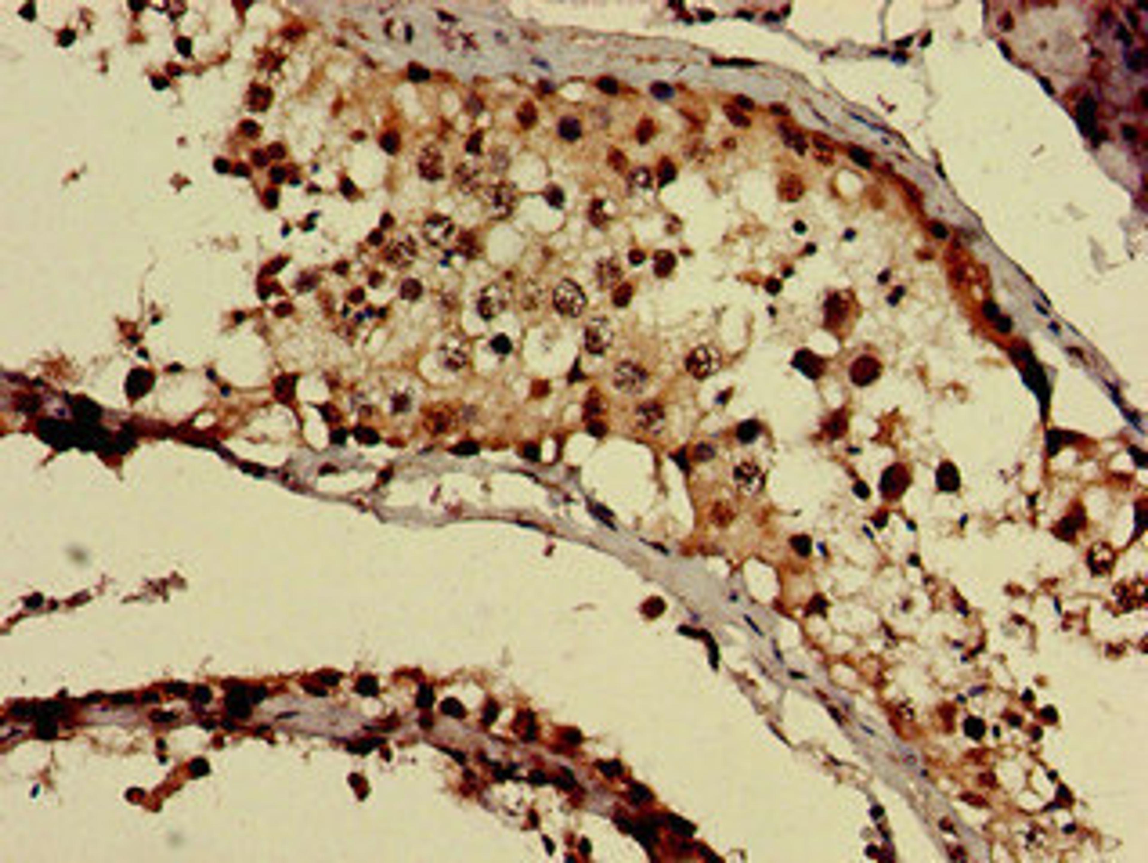 Immunohistochemistry of paraffin-embedded human testis tissue using CSB-PA009594LA01HU at dilution of 1:100