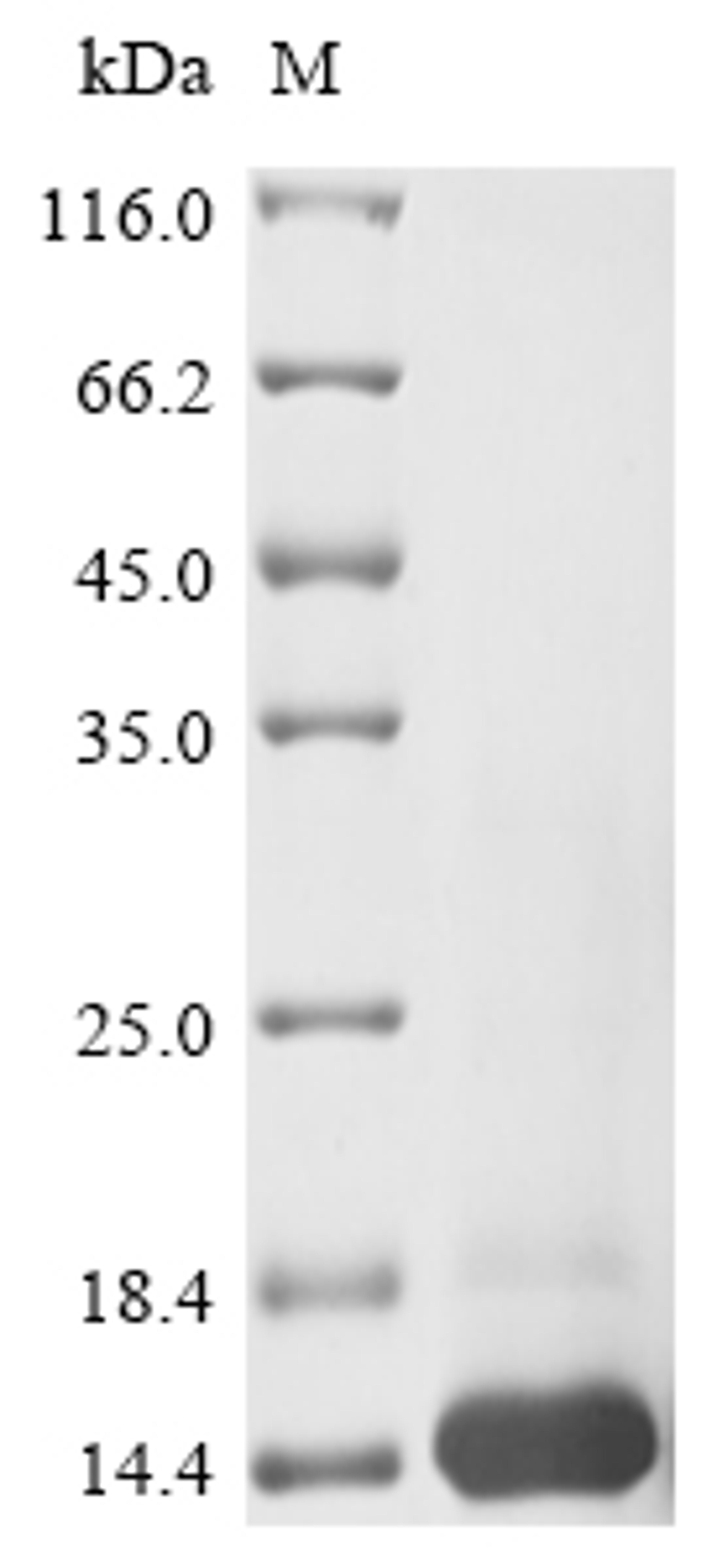 (Tris-Glycine gel) Discontinuous SDS-PAGE (reduced) with 5% enrichment gel and 15% separation gel.