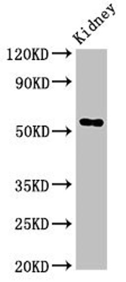 Western Blot. Positive WB detected in: Rat kideny tissue. All lanes: Fuca1 antibody at 3.4ug/ml. Secondary. Goat polyclonal to rabbit IgG at 1/50000 dilution. Predicted band size: 53 kDa. Observed band size: 53 kDa. 
