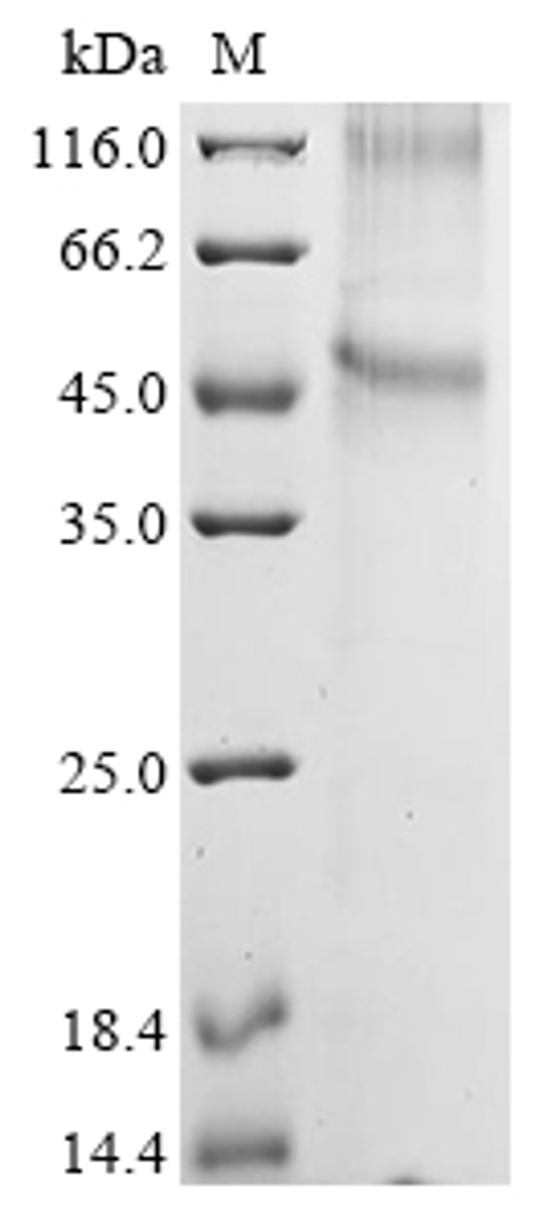 (Tris-Glycine gel) Discontinuous SDS-PAGE (reduced) with 5% enrichment gel and 15% separation gel.