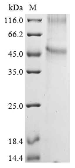 (Tris-Glycine gel) Discontinuous SDS-PAGE (reduced) with 5% enrichment gel and 15% separation gel.