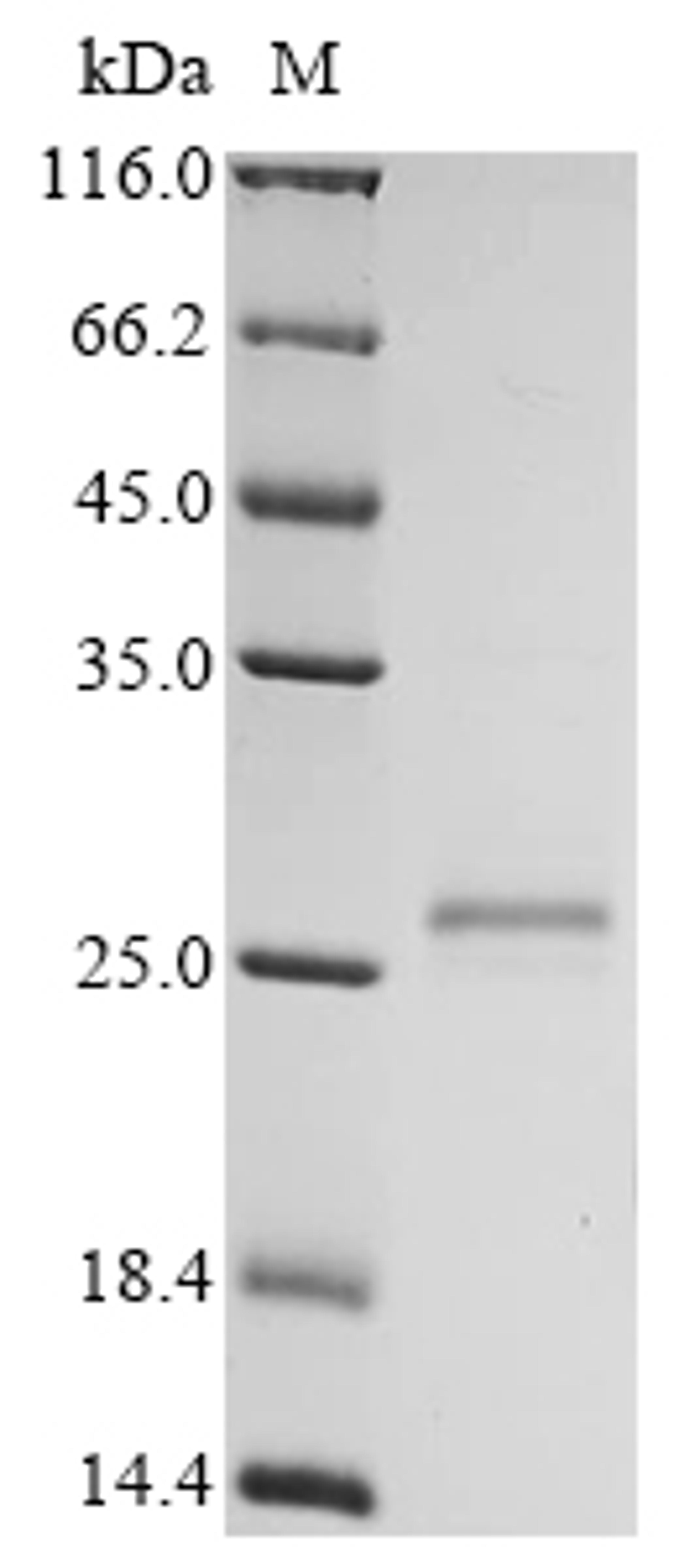 (Tris-Glycine gel) Discontinuous SDS-PAGE (reduced) with 5% enrichment gel and 15% separation gel.