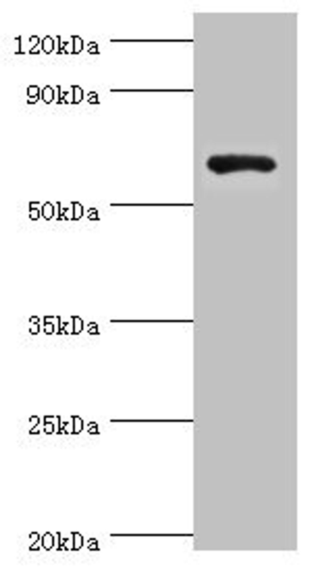 Western blot. All lanes: Glutamate decarboxylase 1 antibody at 8ug/ml + HepG2 whole cell lysate. Secondary. Goat polyclonal to rabbit IgG at 1/10000 dilution. Predicted band size: 67, 26, 48 kDa. Observed band size: 67 kDa. 