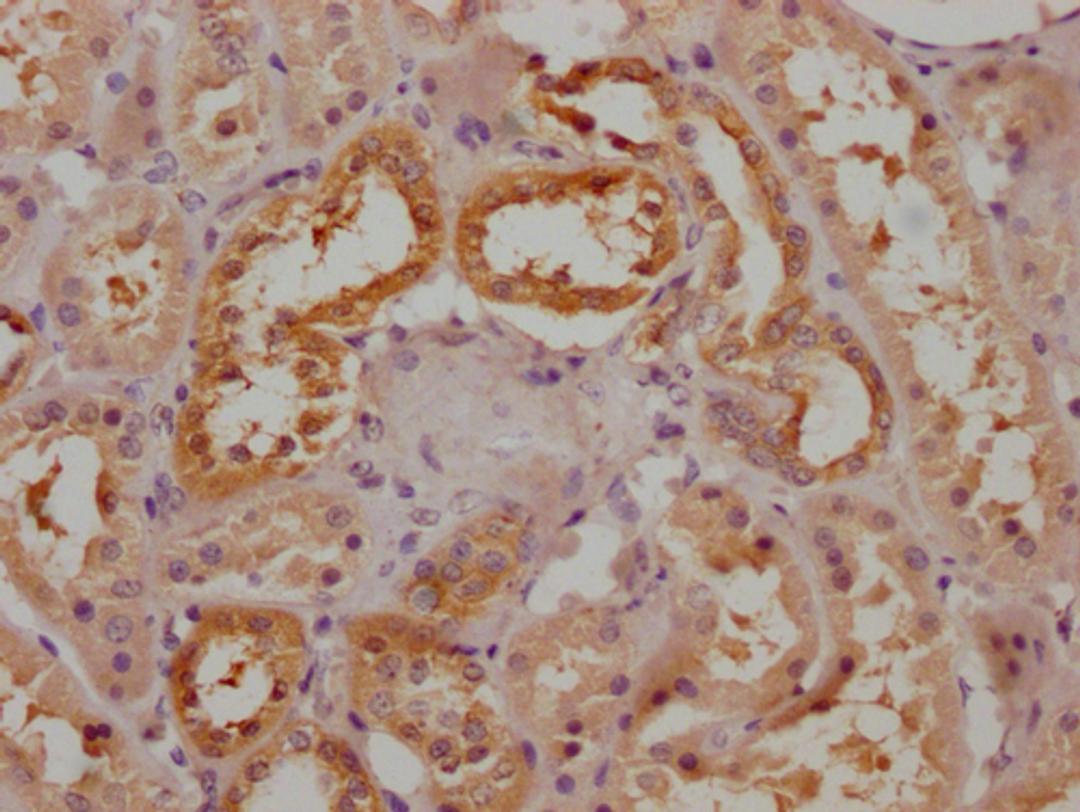IHC image of CSB-PA883653LA01HU diluted at 1:200 and staining in paraffin-embedded human kidney tissue performed on a Leica BondTM system. After dewaxing and hydration, antigen retrieval was mediated by high pressure in a citrate buffer (pH 6.0). Section was blocked with 10% normal goat serum 30min at RT. Then primary antibody (1% BSA) was incubated at 4°C overnight. The primary is detected by a Goat anti-rabbit polymer IgG labeled by HRP and visualized using 0.05% DAB.