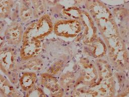 IHC image of CSB-PA883653LA01HU diluted at 1:200 and staining in paraffin-embedded human kidney tissue performed on a Leica BondTM system. After dewaxing and hydration, antigen retrieval was mediated by high pressure in a citrate buffer (pH 6.0). Section was blocked with 10% normal goat serum 30min at RT. Then primary antibody (1% BSA) was incubated at 4°C overnight. The primary is detected by a Goat anti-rabbit polymer IgG labeled by HRP and visualized using 0.05% DAB.