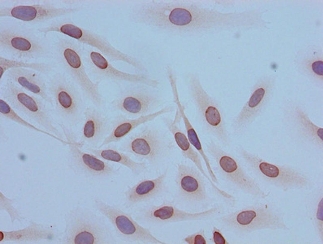 Immunocytochemistry analysis of Hela cells using CSB-PA010429PA12acHU at dilution of 1:100