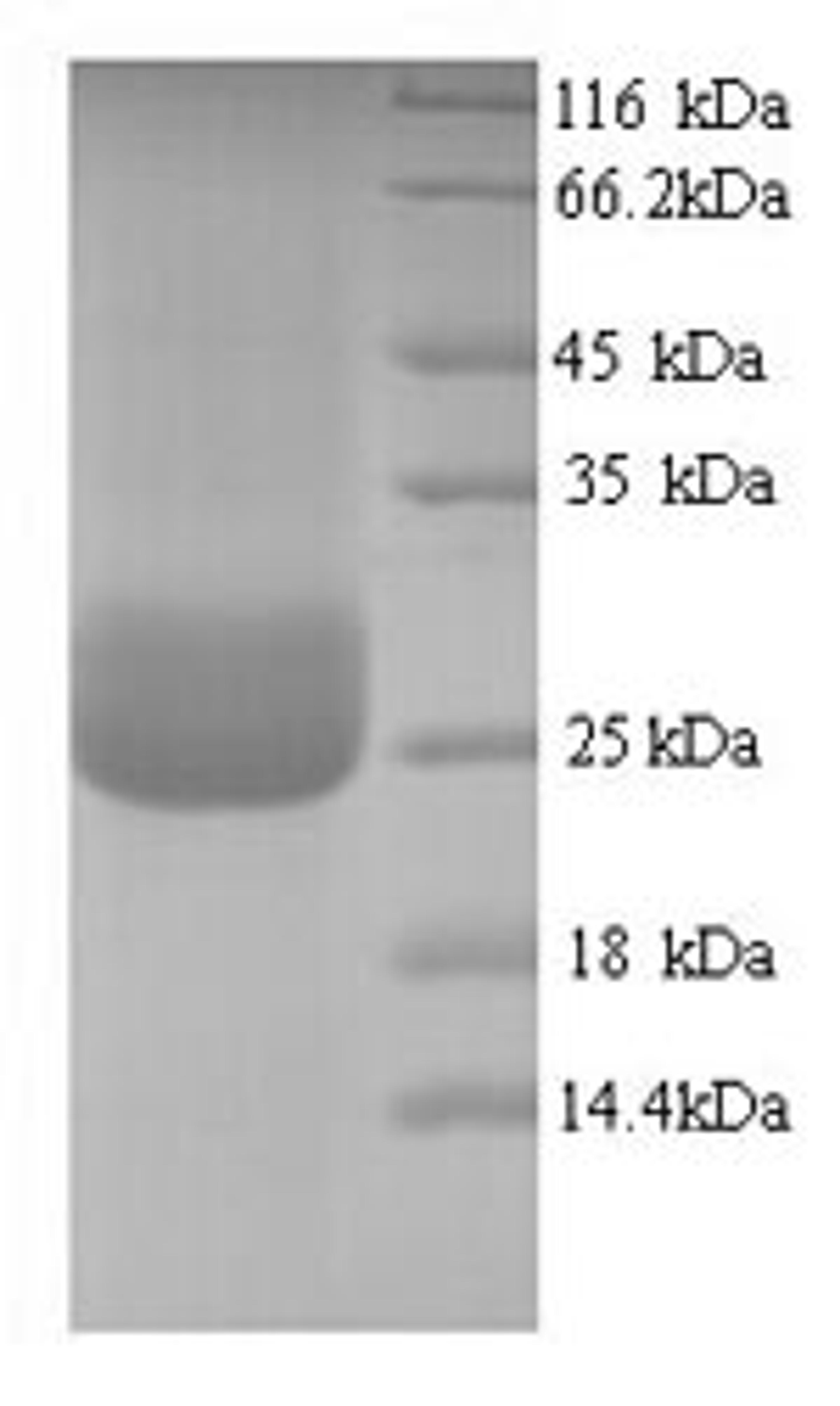 (Tris-Glycine gel) Discontinuous SDS-PAGE (reduced) with 5% enrichment gel and 15% separation gel.
