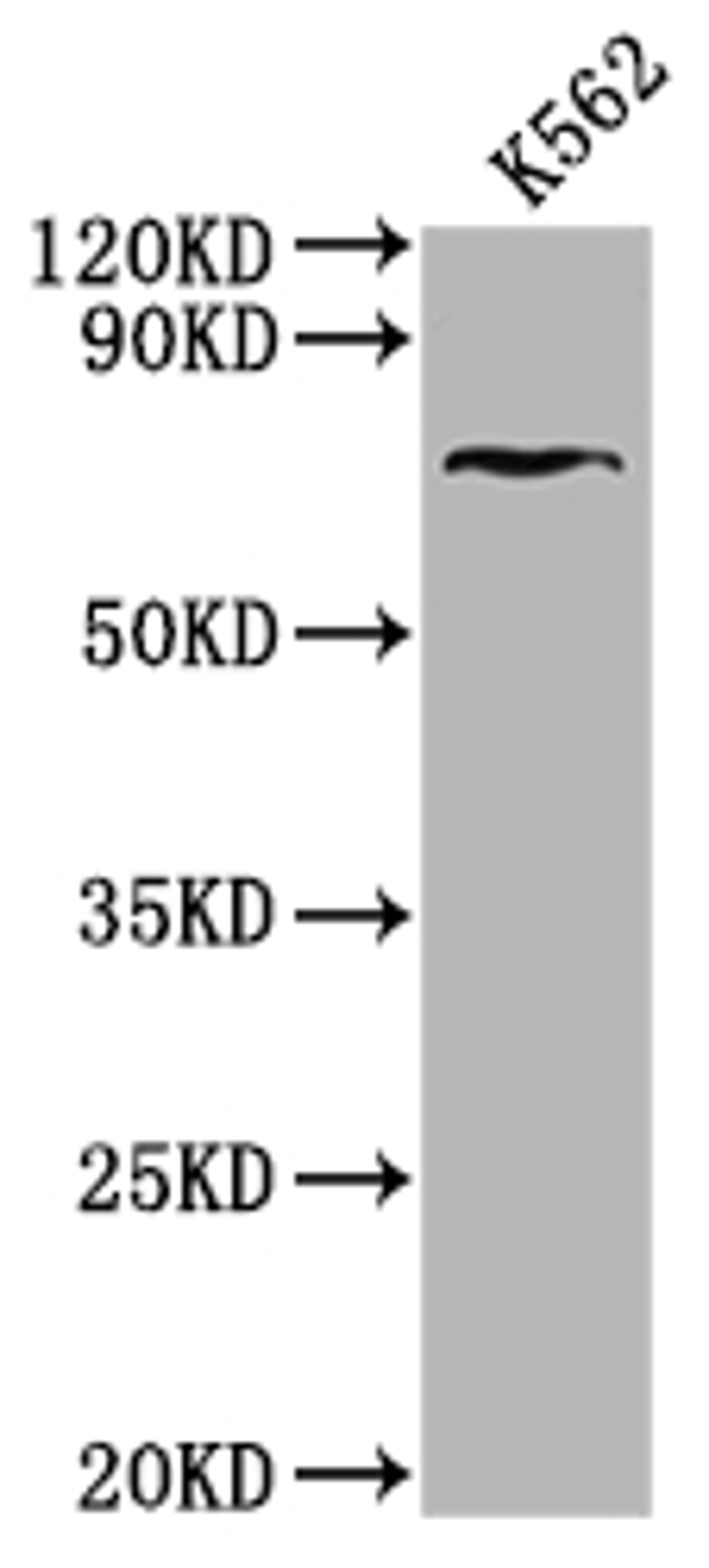 Western Blot. Positive WB detected in: K562 whole cell lysate. All lanes: HHIP antibody at 1:2000. Secondary. Goat polyclonal to rabbit IgG at 1/50000 dilution. Predicted band size: 79, 37 kDa. Observed band size: 79 kDa. 