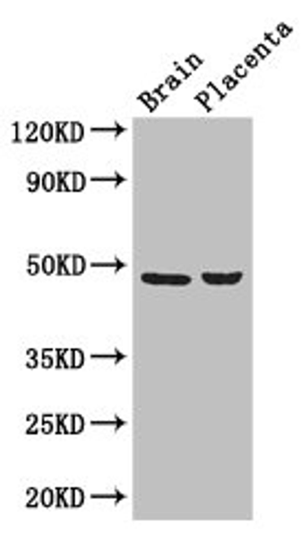 Western Blot. Positive WB detected in: Mouse brain tissue, Human placenta tissue. All lanes: CD177 antibody at 3ug/ml. Secondary. Goat polyclonal to rabbit IgG at 1/50000 dilution. Predicted band size: 47, 28, 16 kDa. Observed band size: 47 kDa. 