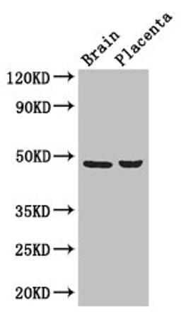 Western Blot. Positive WB detected in: Mouse brain tissue, Human placenta tissue. All lanes: CD177 antibody at 3ug/ml. Secondary. Goat polyclonal to rabbit IgG at 1/50000 dilution. Predicted band size: 47, 28, 16 kDa. Observed band size: 47 kDa. 