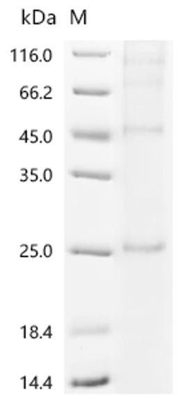 (Tris-Glycine gel) Discontinuous SDS-PAGE (reduced) with 5% enrichment gel and 15% separation gel.