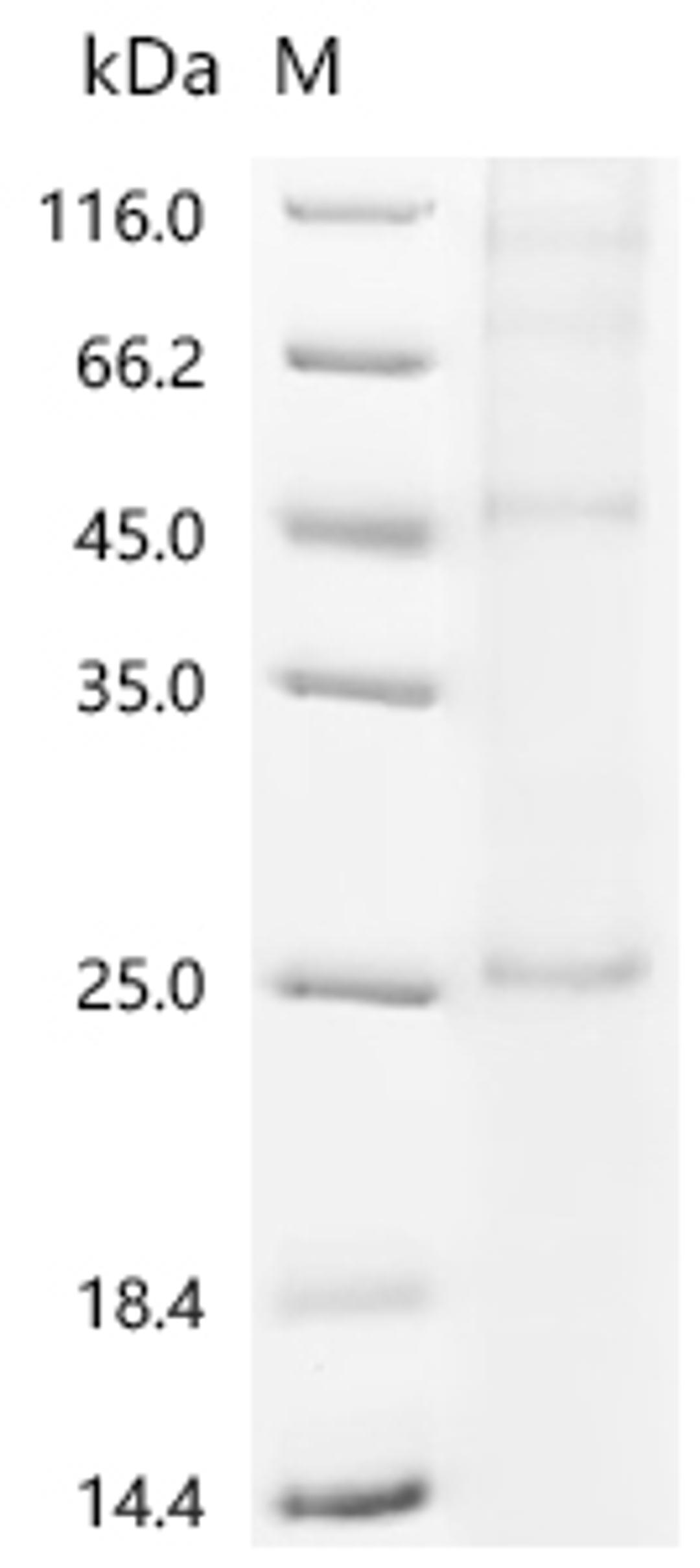 (Tris-Glycine gel) Discontinuous SDS-PAGE (reduced) with 5% enrichment gel and 15% separation gel.
