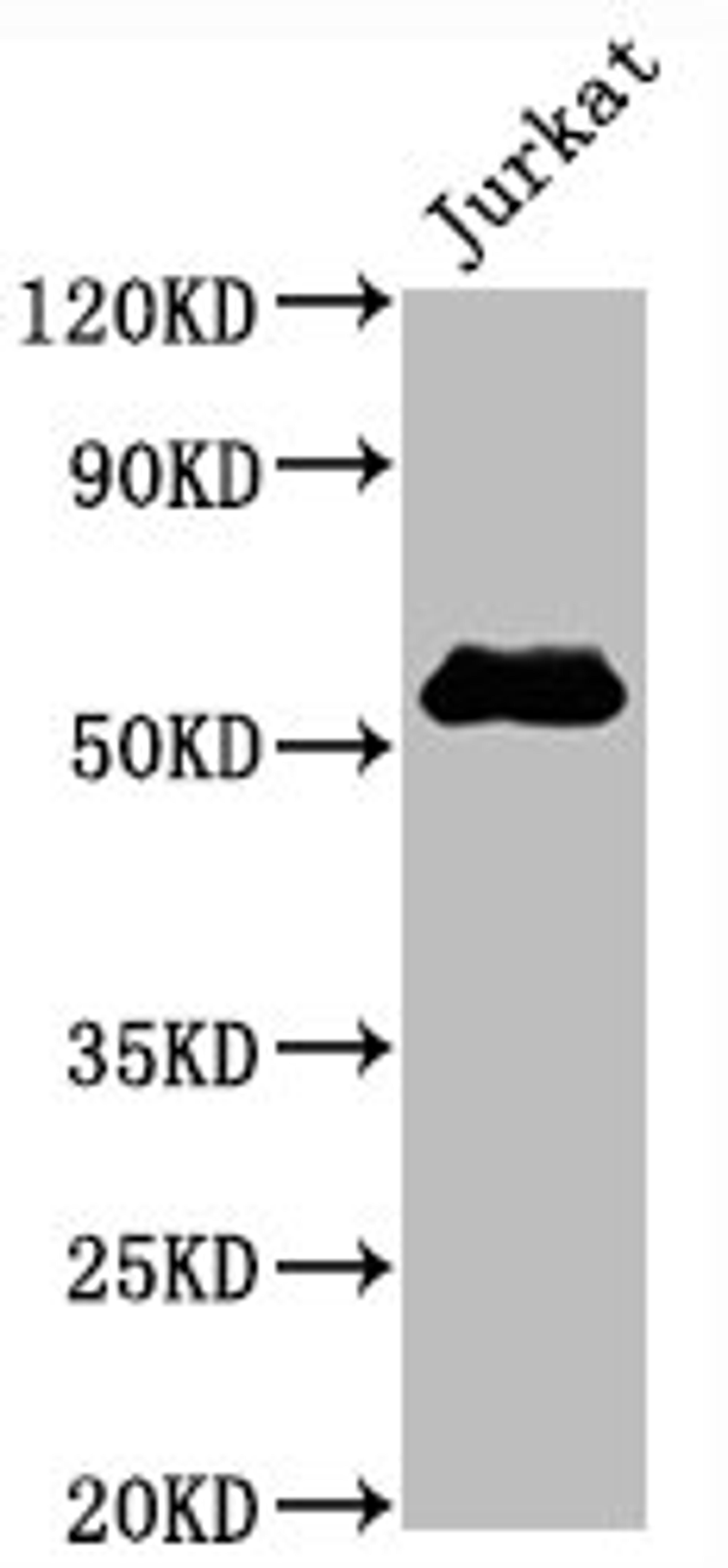 Western Blot. Positive WB detected in Jurkat whole cell lysate. All lanes CD4 antibody at 0.8μg/ml. Secondary. Goat polyclonal to rabbit IgG at 1/50000 dilution. Predicted band size: 55 KDa. Observed band size: 55 KDa. 