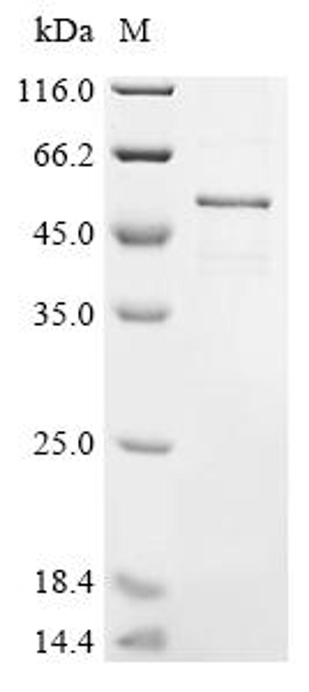 (Tris-Glycine gel) Discontinuous SDS-PAGE (reduced) with 5% enrichment gel and 15% separation gel.