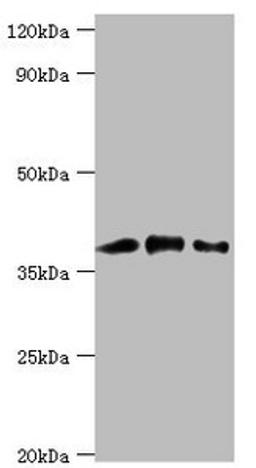 Western blot. All lanes: Macrophage-capping protein antibody at 1ug/ml. Lane 1: Hela whole cell lysate. Lane 2: NIH/3T3 whole cell lysate. Lane 3: Rat lung tissue. Secondary. Goat polyclonal to rabbit IgG at 1/10000 dilution. Predicted band size: 39, 37 kDa. Observed band size: 39 kDa. 