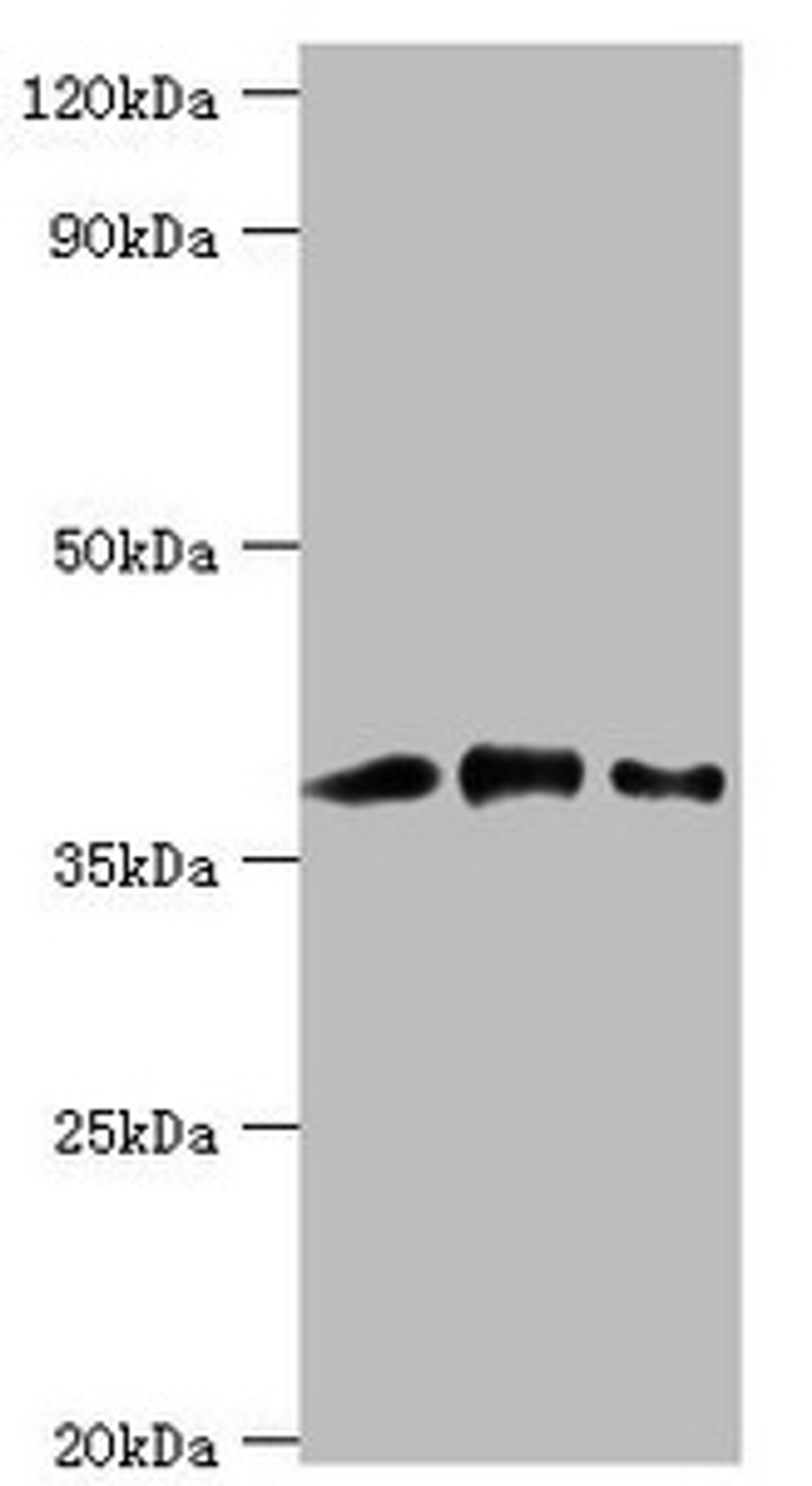 Western blot. All lanes: Macrophage-capping protein antibody at 1ug/ml. Lane 1: Hela whole cell lysate. Lane 2: NIH/3T3 whole cell lysate. Lane 3: Rat lung tissue. Secondary. Goat polyclonal to rabbit IgG at 1/10000 dilution. Predicted band size: 39, 37 kDa. Observed band size: 39 kDa. 