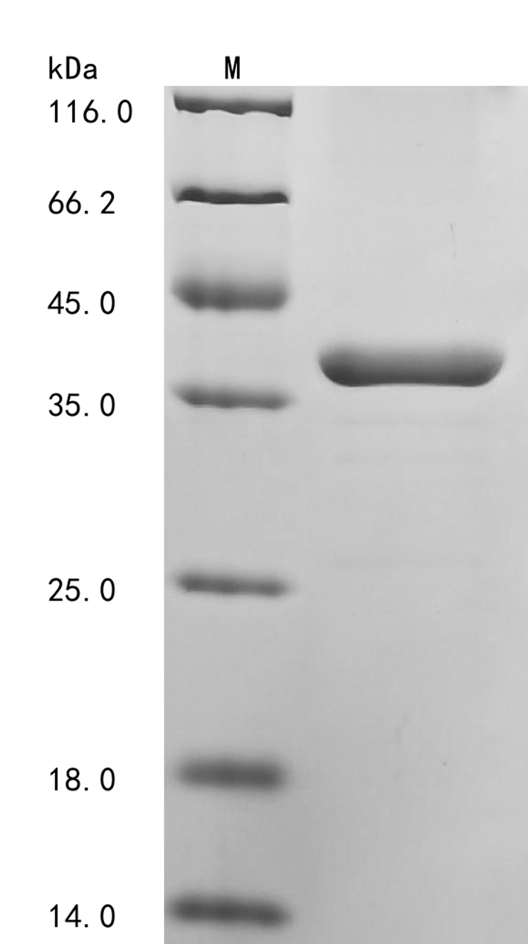 (Tris-Glycine gel) Discontinuous SDS-PAGE (reduced) with 5% enrichment gel and 15% separation gel.
