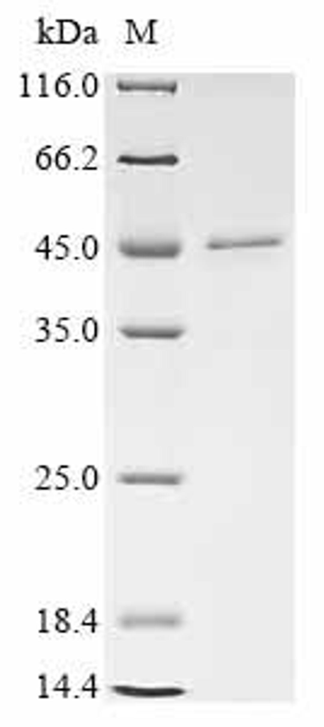 (Tris-Glycine gel) Discontinuous SDS-PAGE (reduced) with 5% enrichment gel and 15% separation gel.