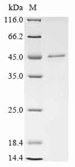 (Tris-Glycine gel) Discontinuous SDS-PAGE (reduced) with 5% enrichment gel and 15% separation gel.