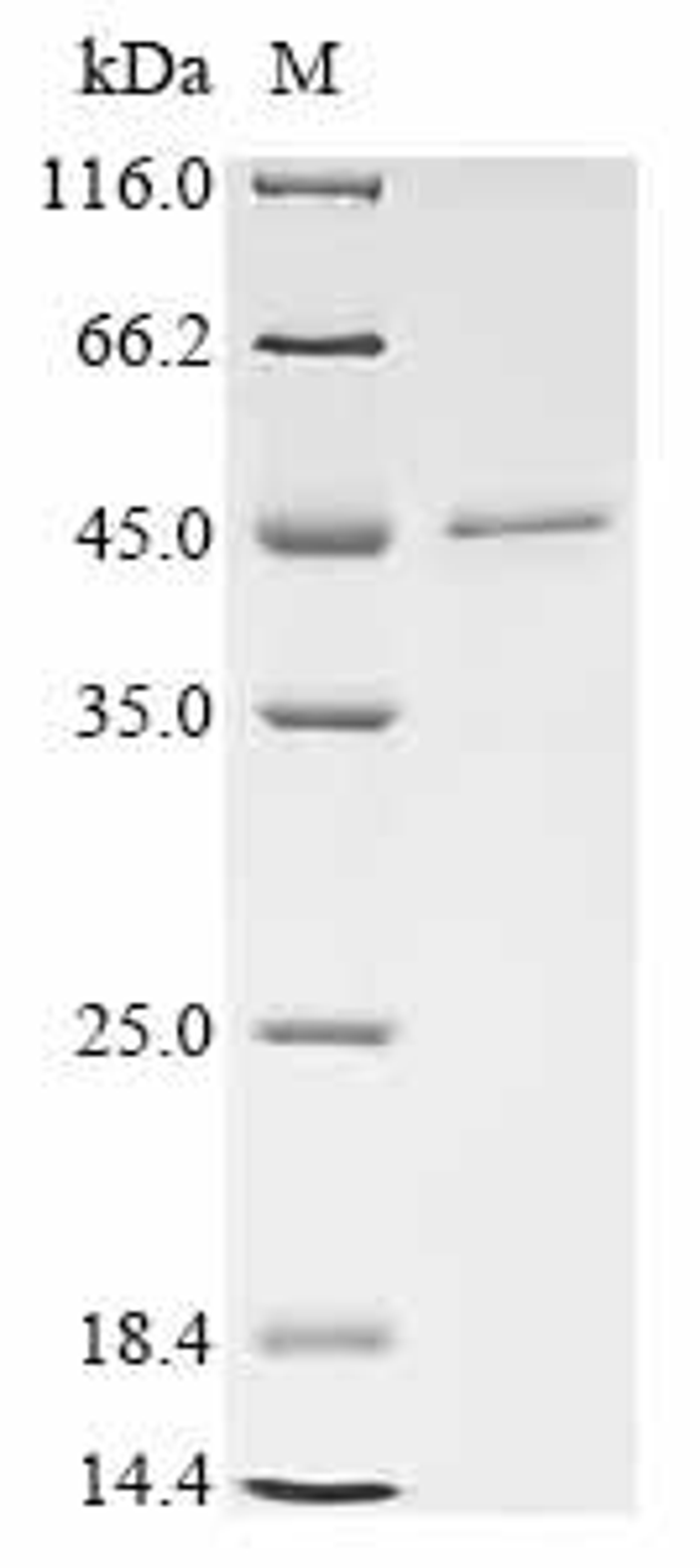(Tris-Glycine gel) Discontinuous SDS-PAGE (reduced) with 5% enrichment gel and 15% separation gel.