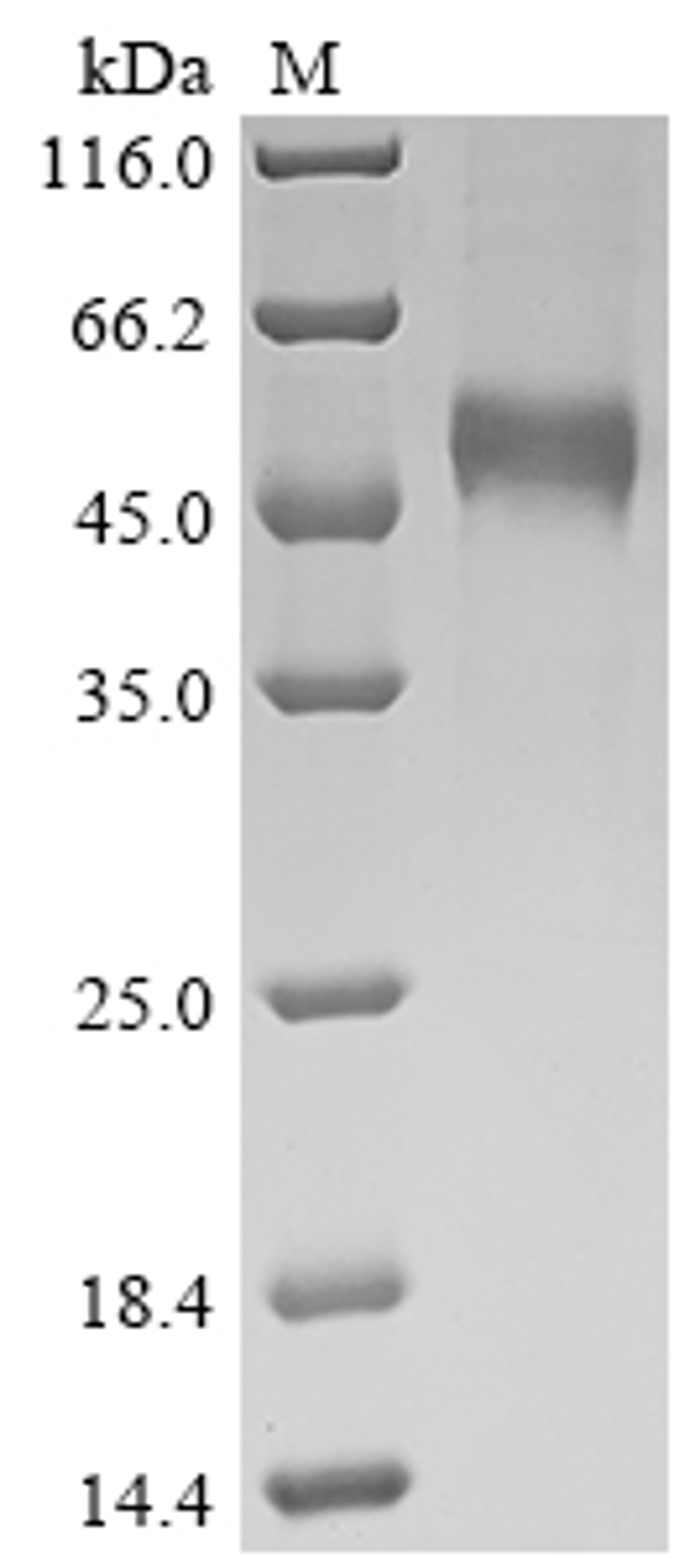 (Tris-Glycine gel) Discontinuous SDS-PAGE (reduced) with 5% enrichment gel and 15% separation gel.