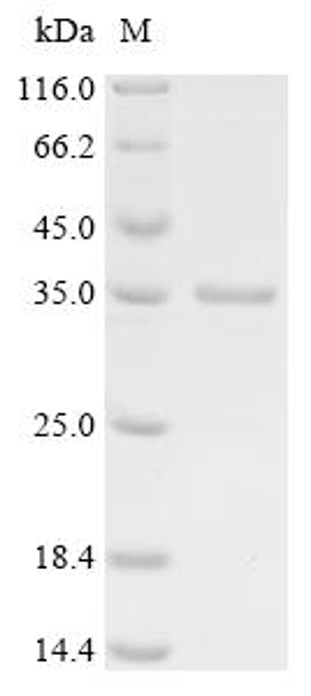 (Tris-Glycine gel) Discontinuous SDS-PAGE (reduced) with 5% enrichment gel and 15% separation gel.