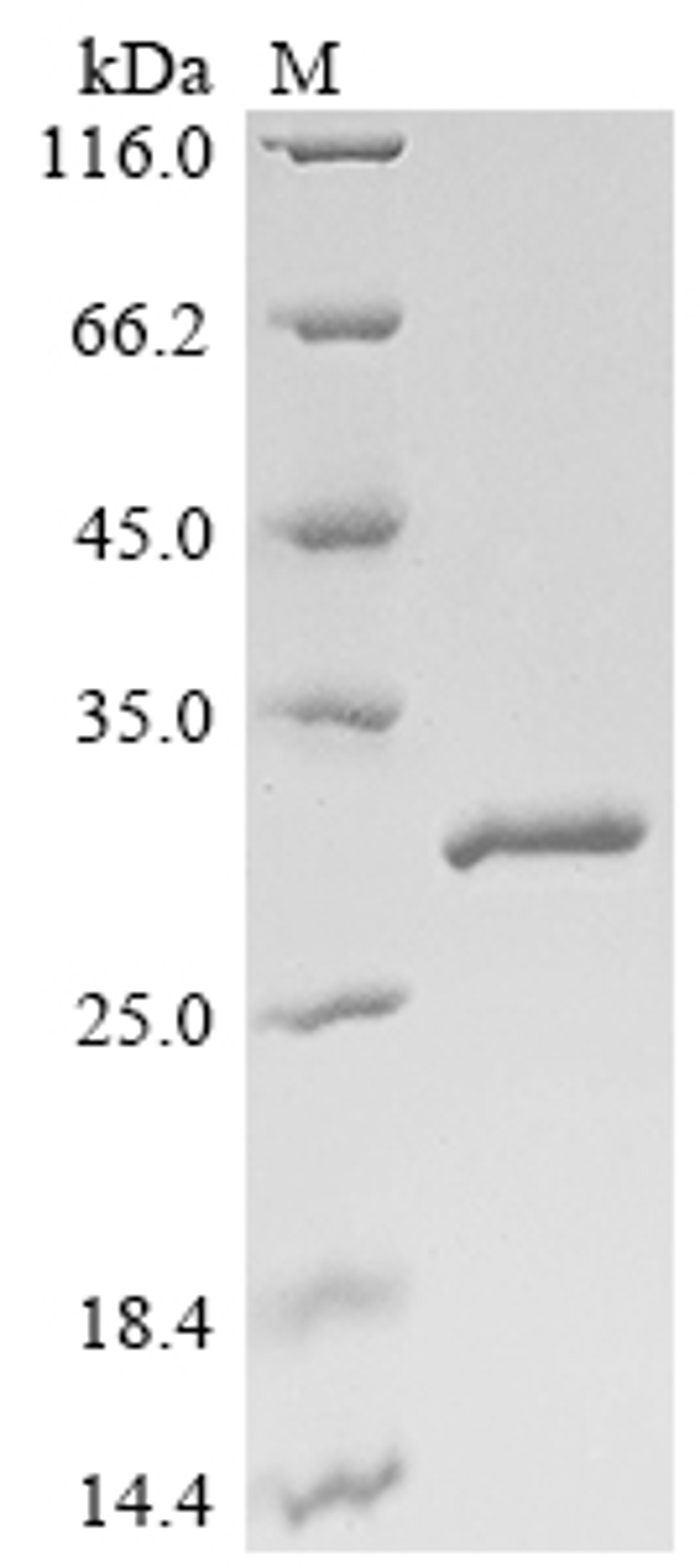 (Tris-Glycine gel) Discontinuous SDS-PAGE (reduced) with 5% enrichment gel and 15% separation gel.