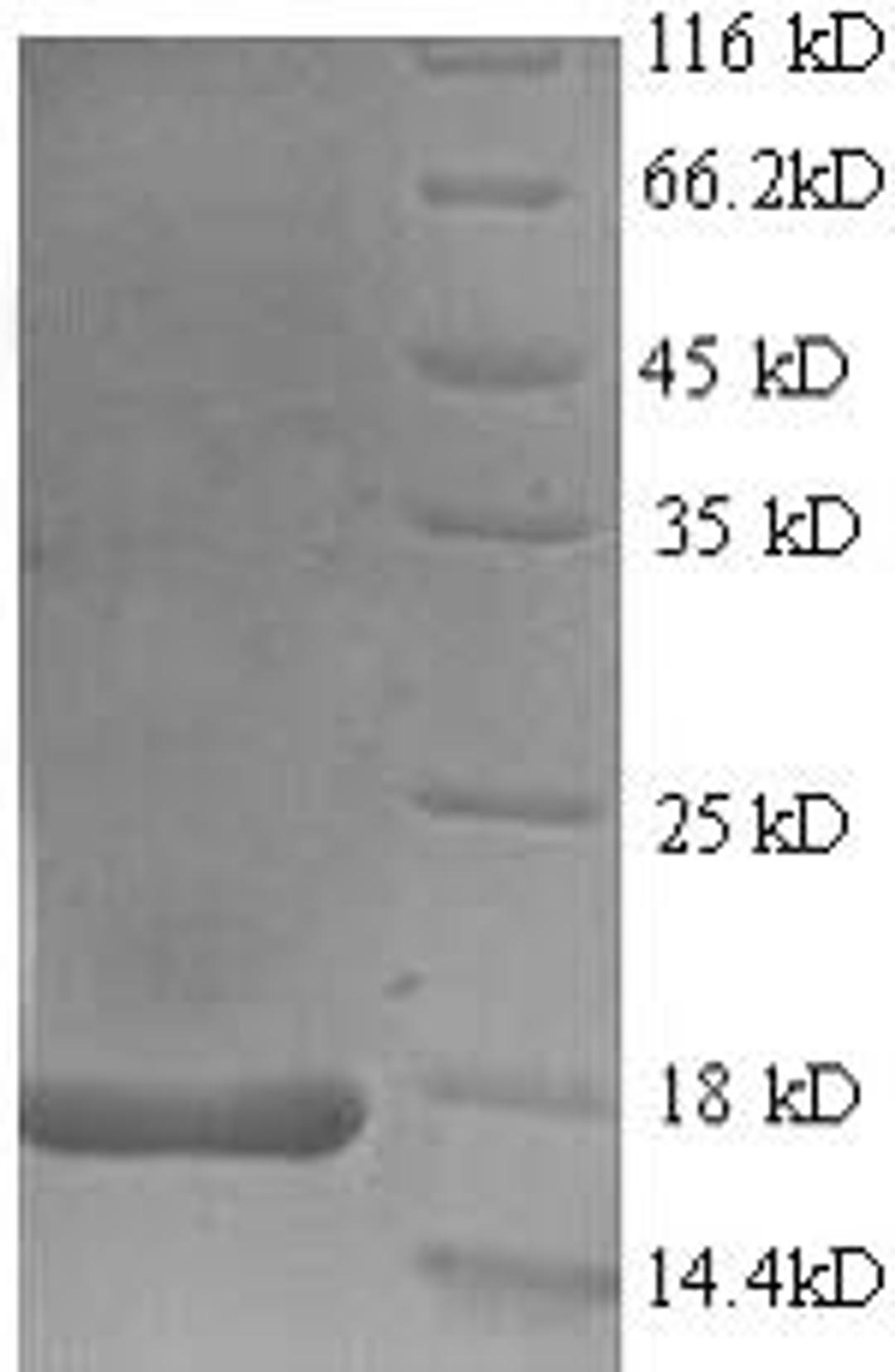 (Tris-Glycine gel) Discontinuous SDS-PAGE (reduced) with 5% enrichment gel and 15% separation gel.