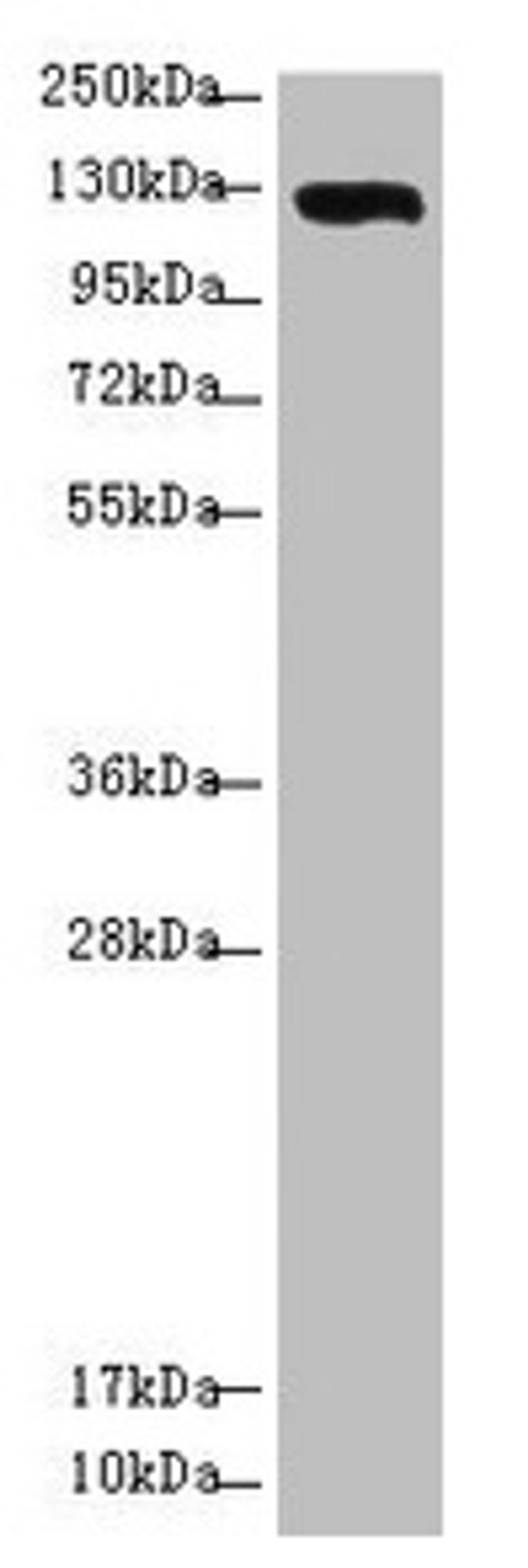 Western blot. All lanes: USP28 antibody at 3.08µg/ml + Hela whole cell lysate. Secondary. Goat polyclonal to rabbit IgG at 1/10000 dilution. Predicted band size: 123, 120, 67 kDa. Observed band size: 123 kDa
