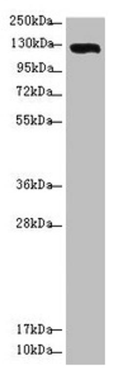 Western blot. All lanes: USP28 antibody at 3.08µg/ml + Hela whole cell lysate. Secondary. Goat polyclonal to rabbit IgG at 1/10000 dilution. Predicted band size: 123, 120, 67 kDa. Observed band size: 123 kDa