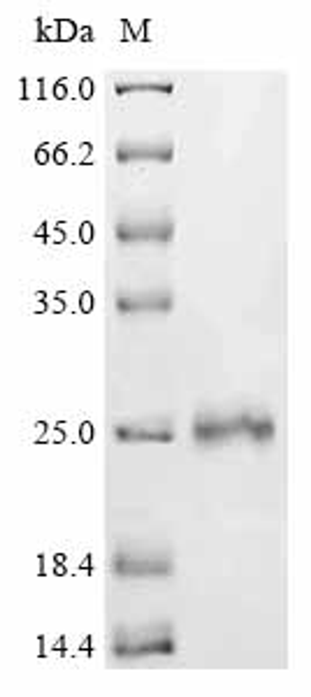 (Tris-Glycine gel) Discontinuous SDS-PAGE (reduced) with 5% enrichment gel and 15% separation gel.