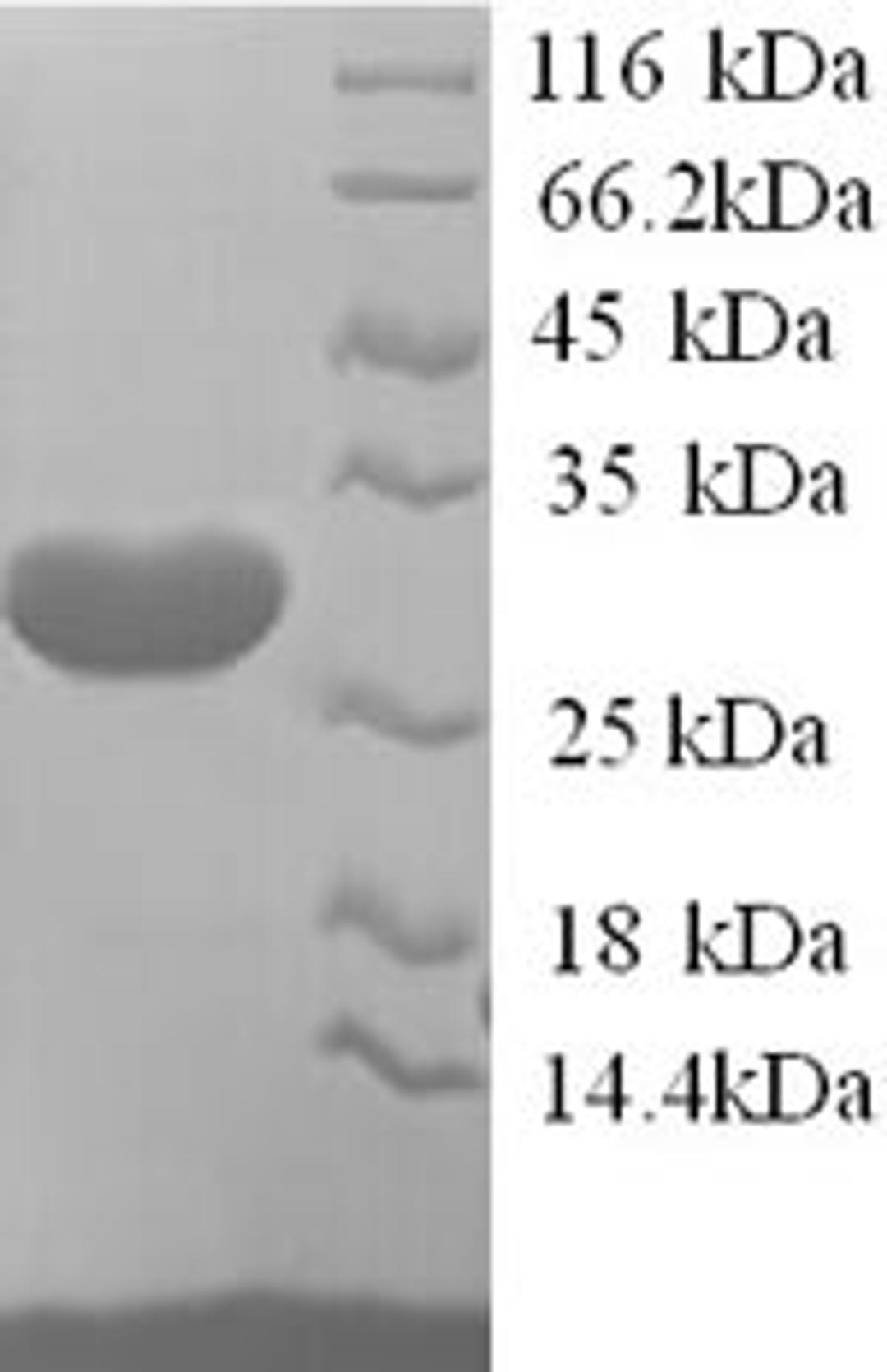 (Tris-Glycine gel) Discontinuous SDS-PAGE (reduced) with 5% enrichment gel and 15% separation gel.