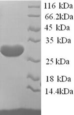(Tris-Glycine gel) Discontinuous SDS-PAGE (reduced) with 5% enrichment gel and 15% separation gel.
