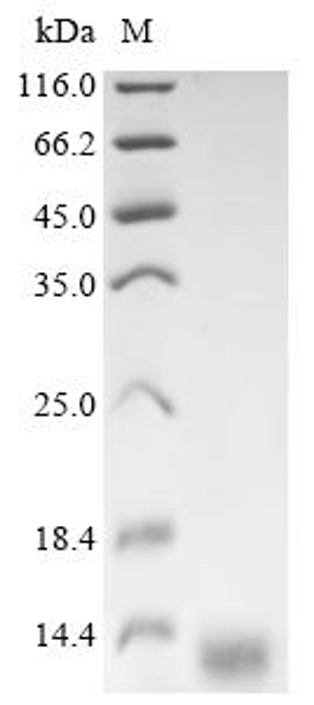 (Tris-Glycine gel) Discontinuous SDS-PAGE (reduced) with 5% enrichment gel and 15% separation gel.